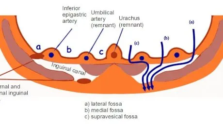 Ce este zona inghinală? Patologia asociată zonei inghinale